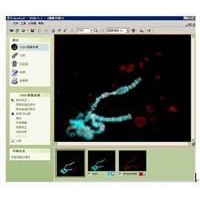 VideoTesT-FISH荧光原位杂交分析系统
