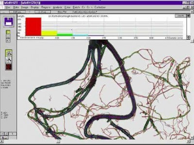 SpectraScan-R根系光谱扫描成像分析