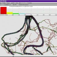 SpectraScan-R根系光谱扫描成像分析系统