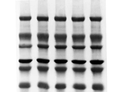 ISEQ00010 Immobilon-PSQ 小孔径PVDF转印膜图1