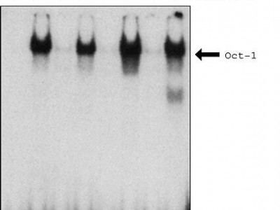 NXTRACT CelLytic™ NuCLEAR™ 提取