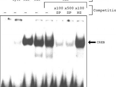 CelLytic  PN 分离/提取试剂盒用于