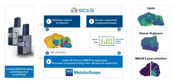 spatialomx-scils-m<i></i>etaboscape.jpeg